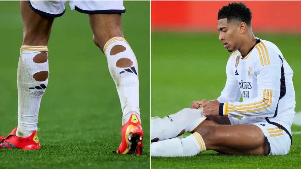 Footballers socks cut Jude