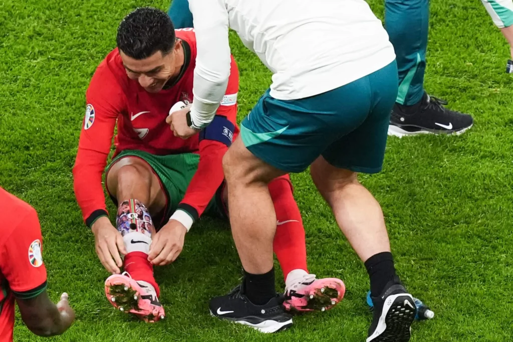 Rules on Shin Pads